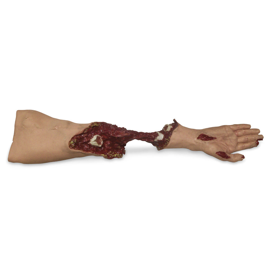 Xtreme Trauma Moulage Arm By Simulaids