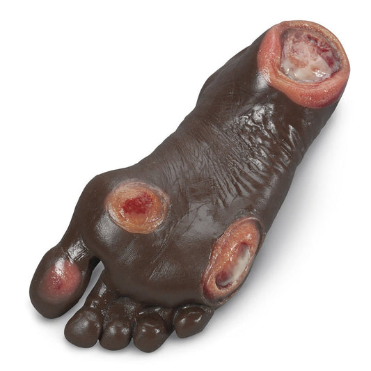 Life/form® Elderly Pressure Ulcer Foot - Dark